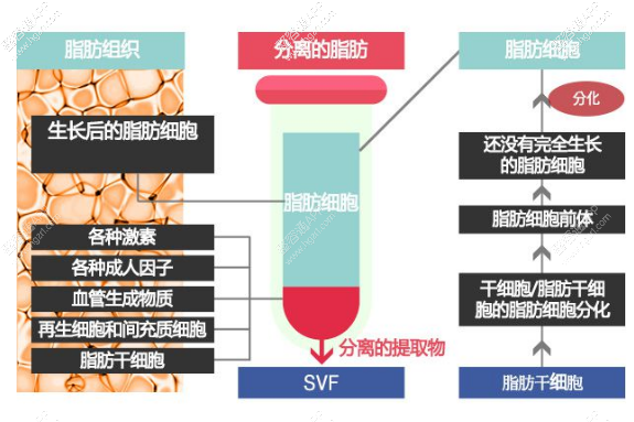 试探他龟头增大术：选择方法1.脂肪移植