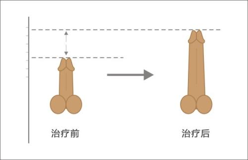 看过男性生殖器解剖图的朋友可能已经知道