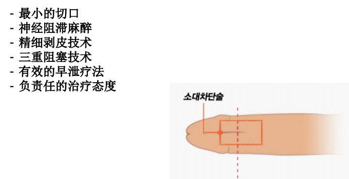 系带神经阻断手术：降低龟头的敏感度