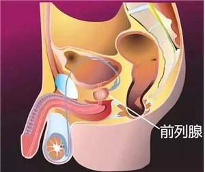 前列腺有“三大怪”：