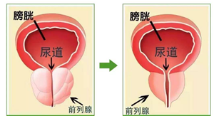 保健饮品和草药：