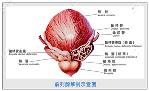 2、术后拔出排尿管