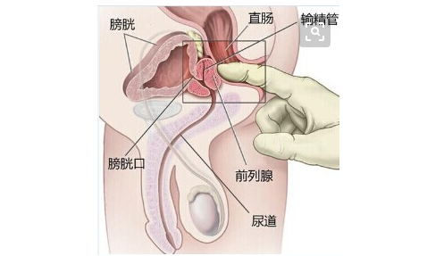 前列腺是男性身体生殖器官的一个重要部位