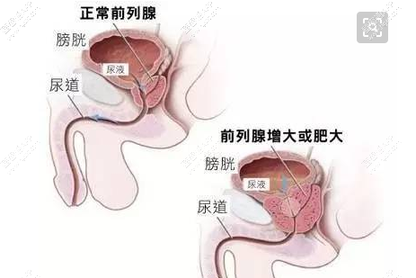 相比之下