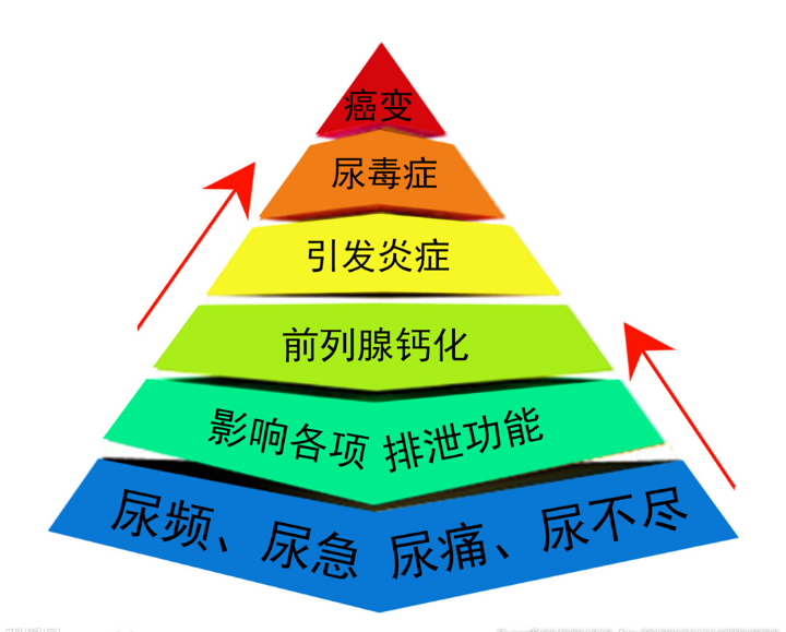 前列腺是将睾酮转化为二氢睾酮的转化器