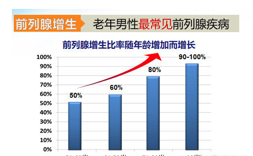 前列腺肥大也叫前列腺增生