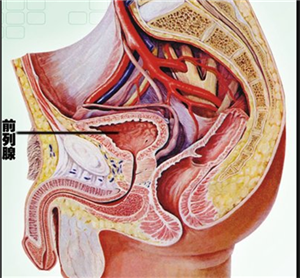 前列腺增生是一种比较常见的男性疾病