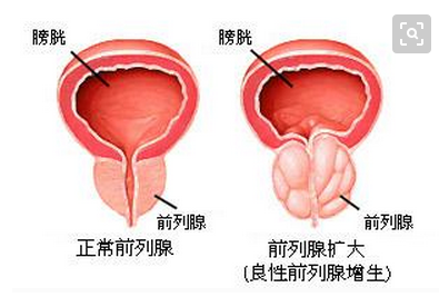 （2）病理研究